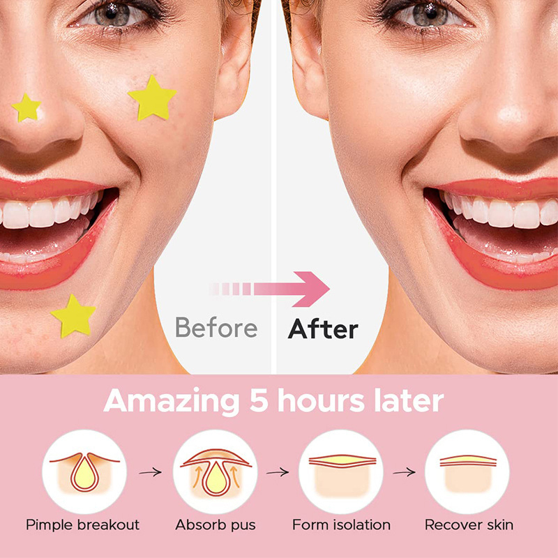 600 Piezas/Set Parches de Estr - Makeup And Beauty reseña y precio